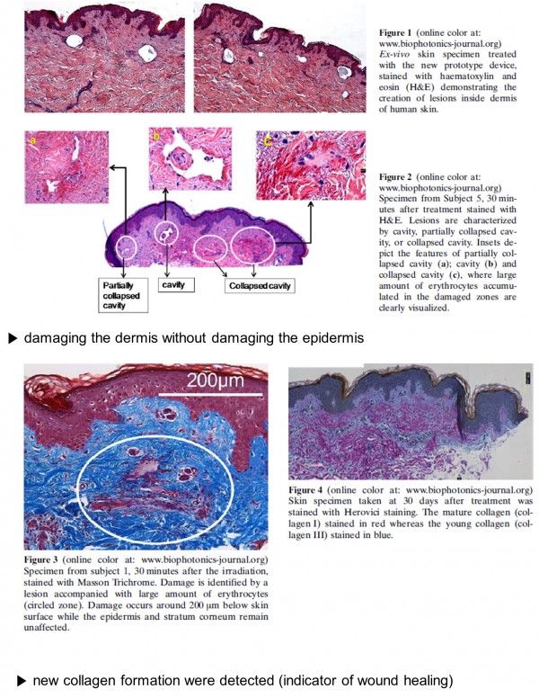 8b9d3621672c74ff0844a830dabbfd18_1489480