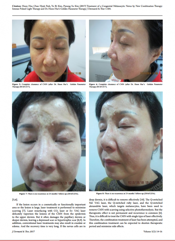 38094386fb9016cf4f50c8ed2d6a6de7_1492591