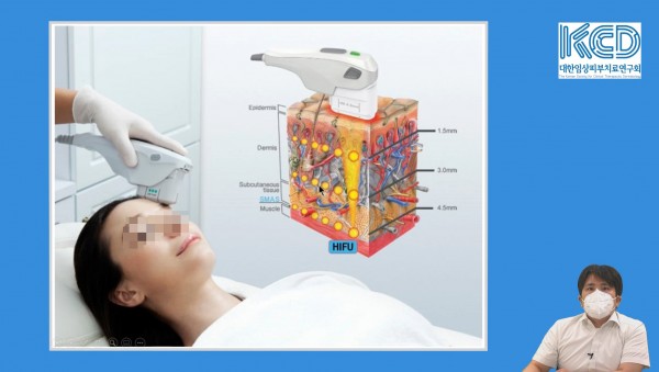 caceaa6b3ea3aa71bd07137368f9f83b_1642900