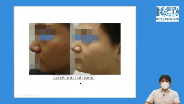 358cd43ebe6a86a1728cf921d8b023f6_1644107